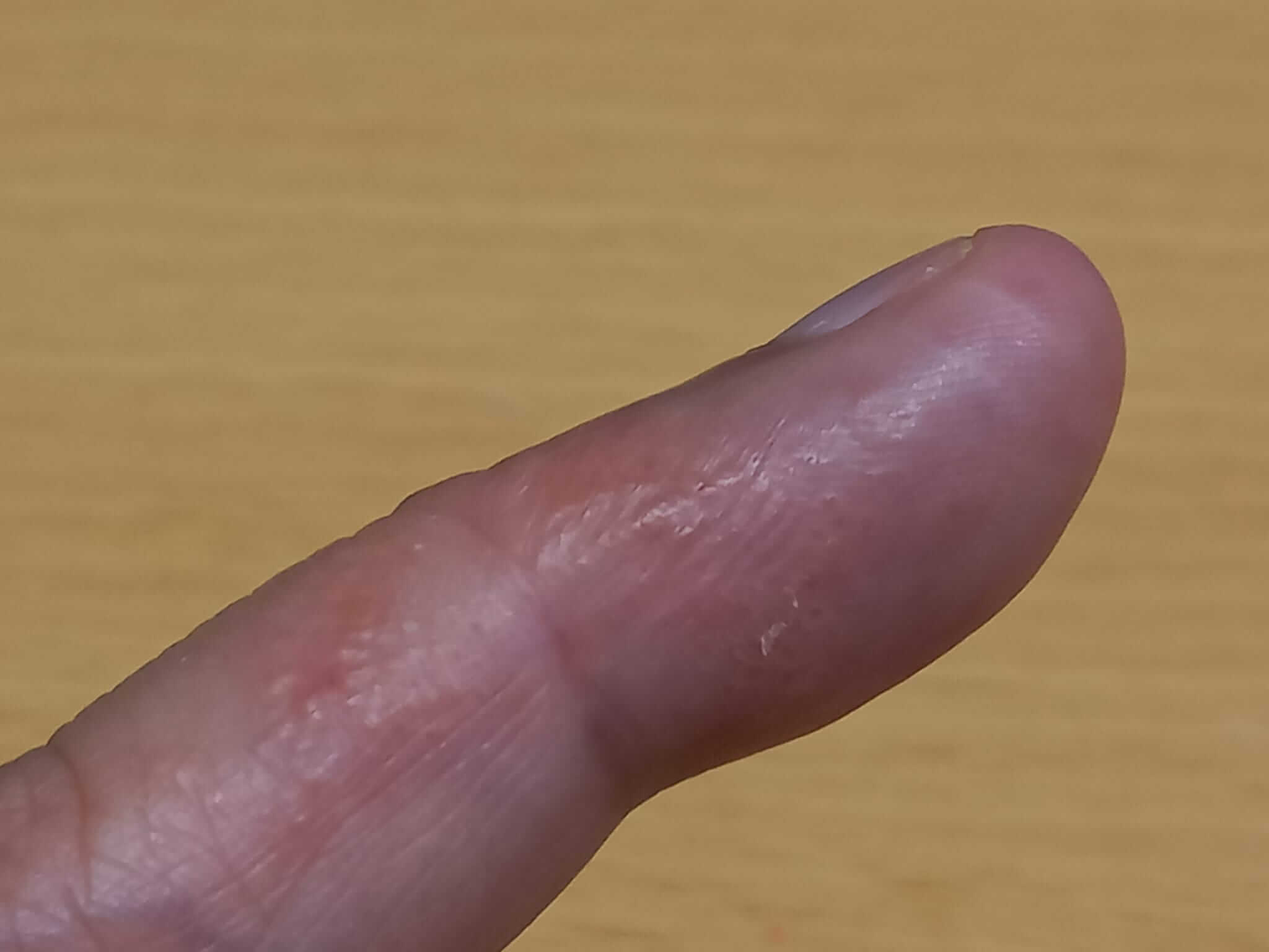 post-thumbnail
