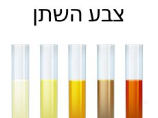 הצבע והריח של השתן